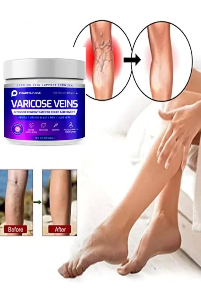 Maximum Strength Varicose Vein Var.is Bacak Bakım Masaj Kremi 100 ml x 2 adet