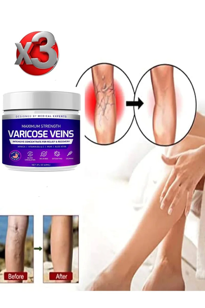 Maximum Strength Varicose Veins Bakım Kremi 100 ml x 3 adet
