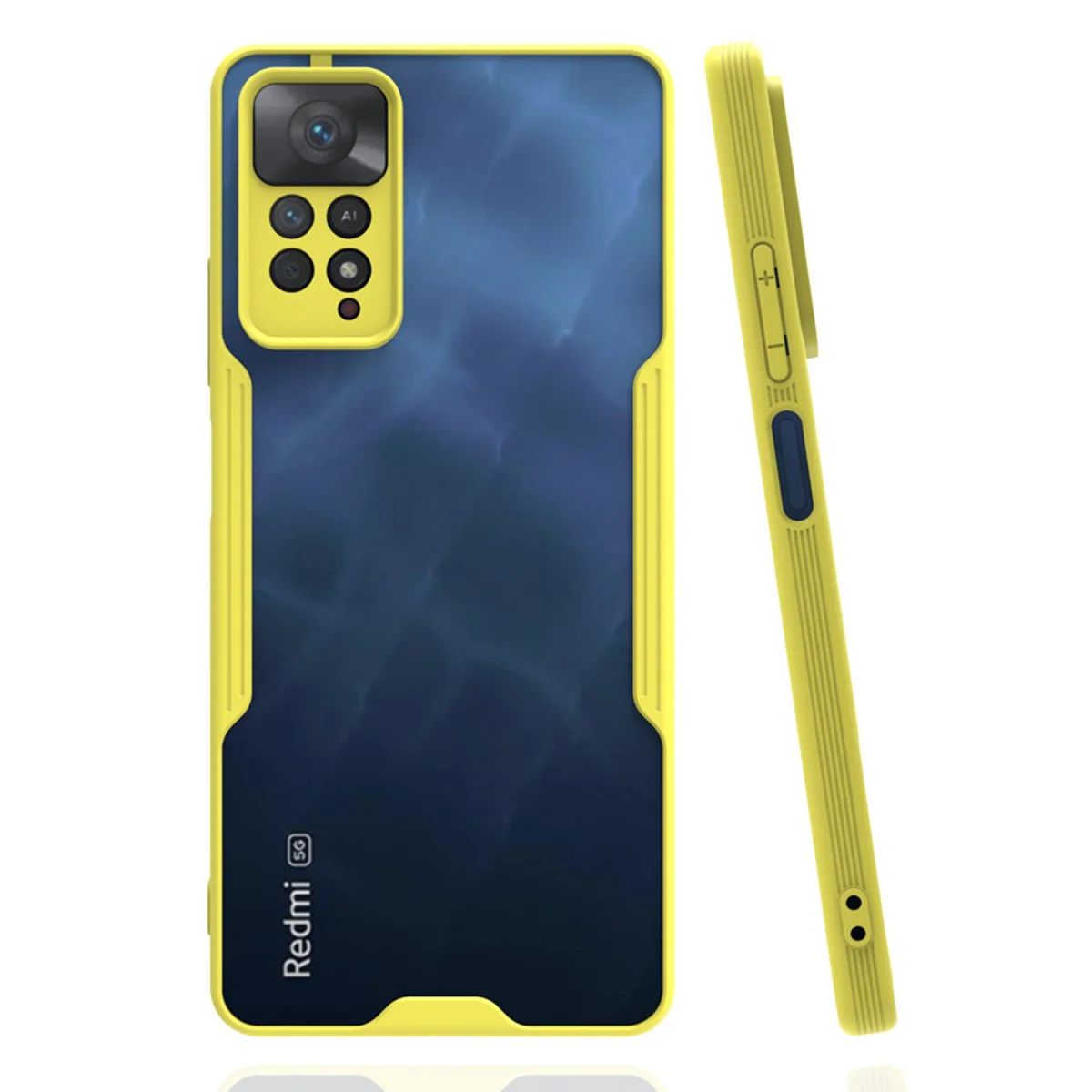 Redmi Note 11 Pro Kılıf Platin Silikon - Sarı