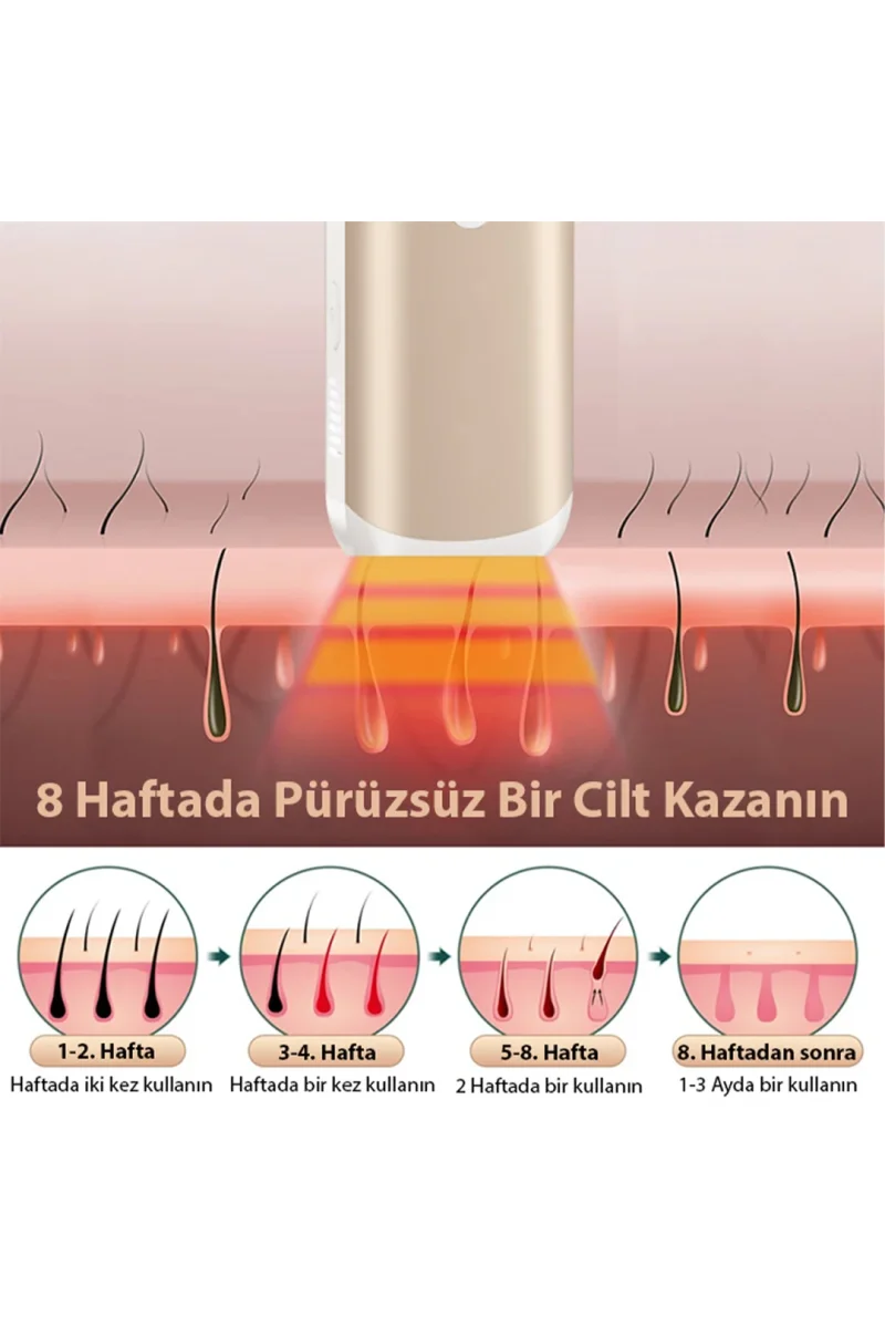 EZERE IPL Buz Lazer Epilasyon 999.999 Atim Otomatik/manuel Dokunmatik Ekran Agrisiz Vücut Yüz Cihazi-(5775)