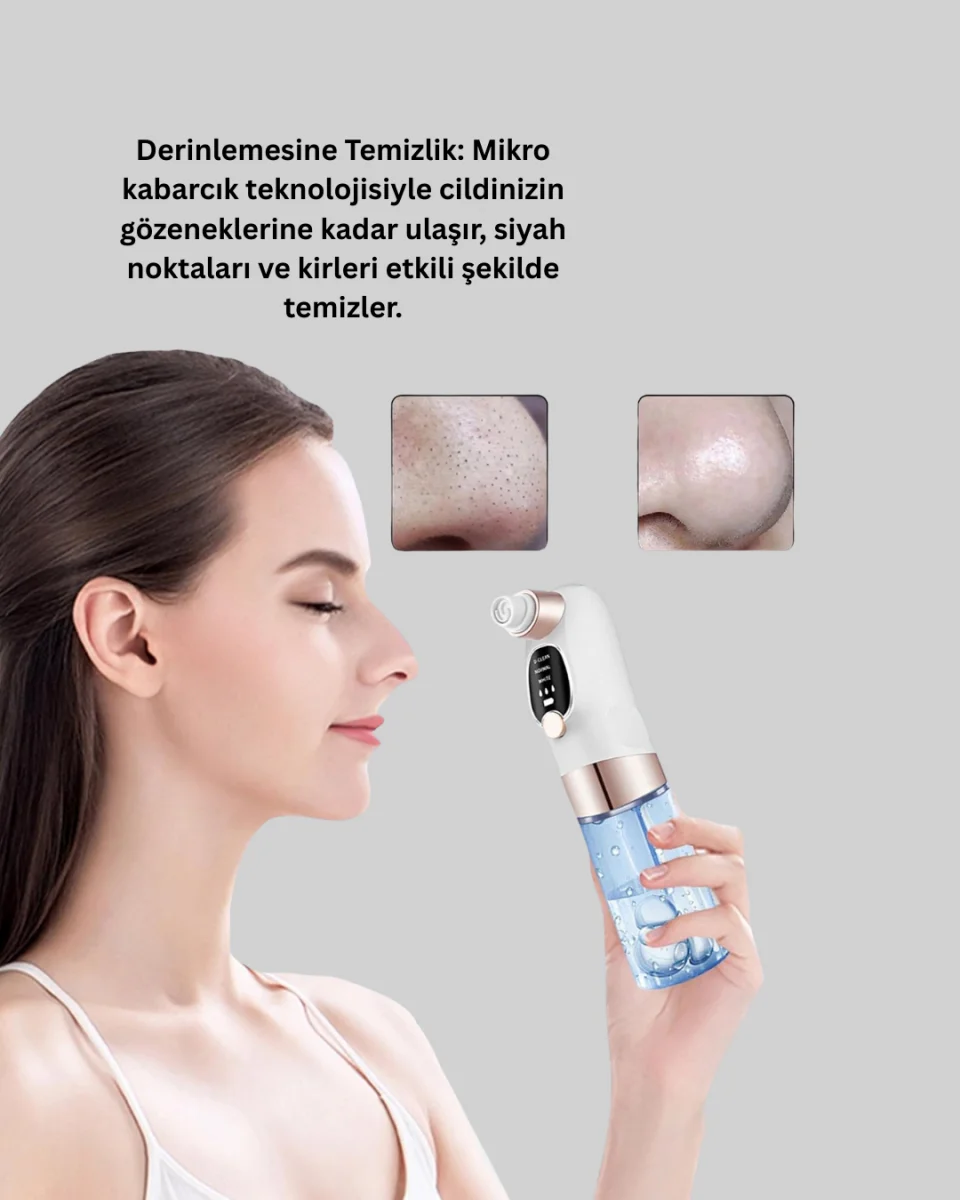 Evde Kolay Kullanım İçin Şarjlı Siyah Nokta Temizleme Aleti