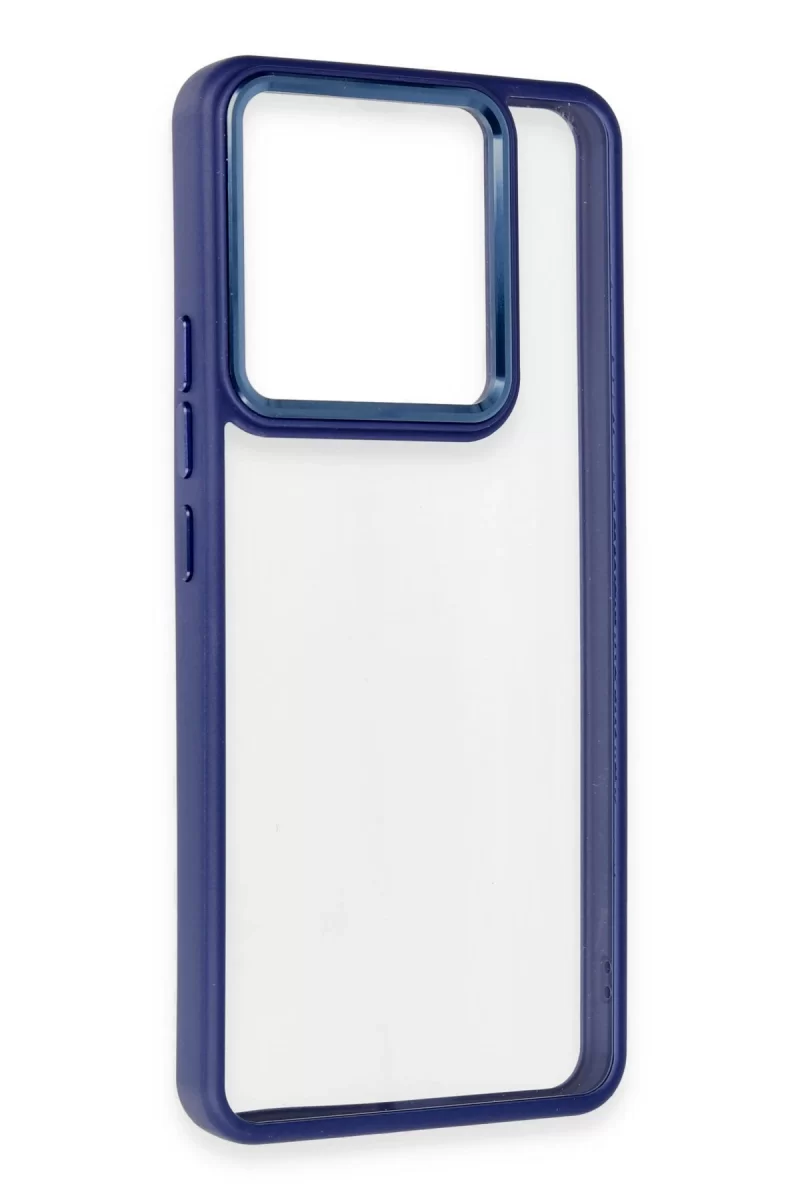 Newface Xiaomi Redmi Note 13 Pro 4G Kılıf Power Silikon - Lacivert