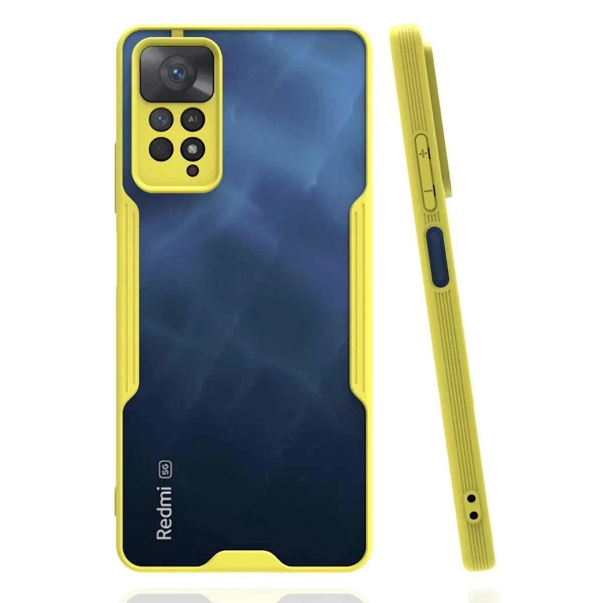 Newface Xiaomi Redmi Note 11 Pro Kılıf Platin Silikon - Sarı