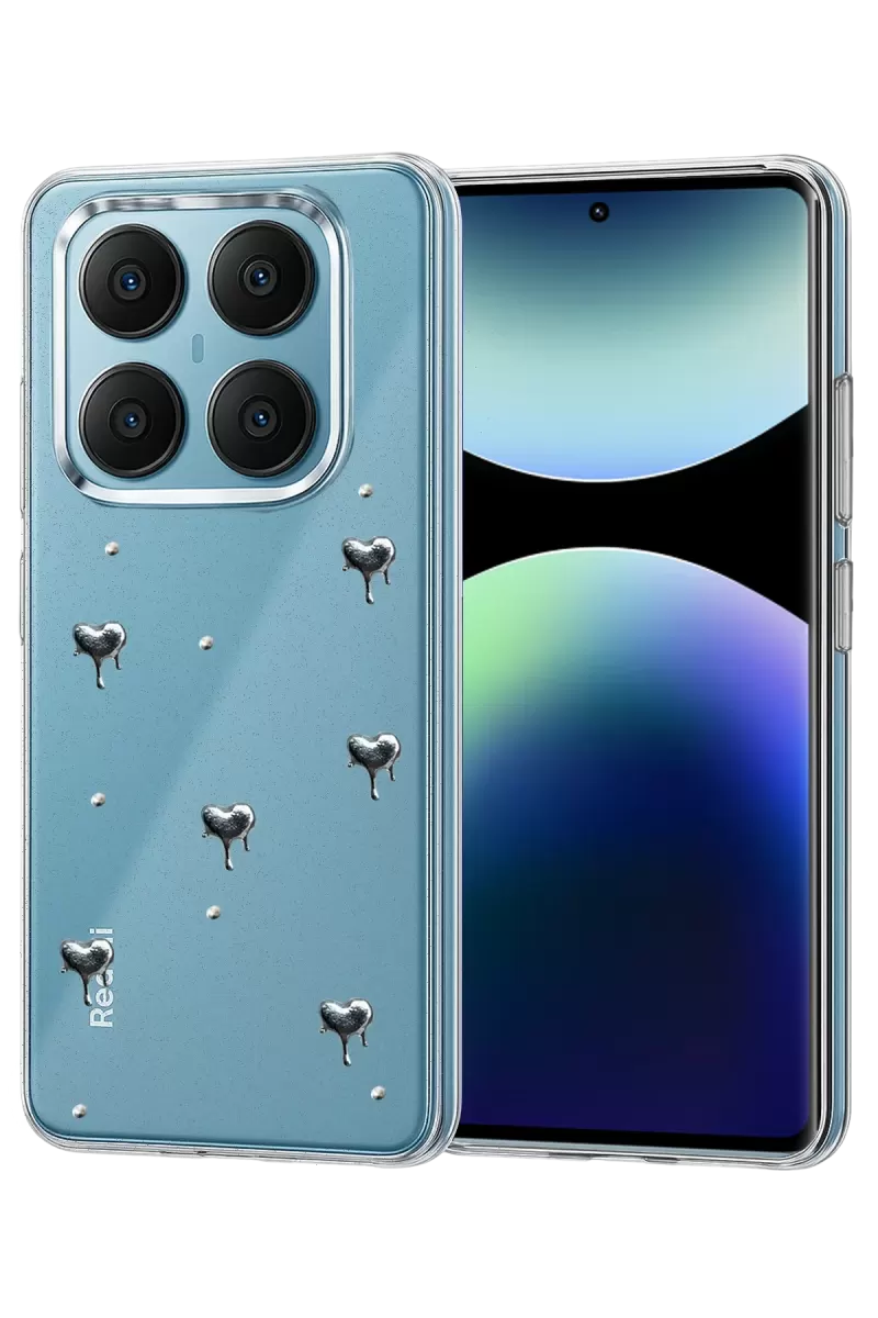 Newface Xiaomi Redmi Note 14 Pro 4G Fiyonk Desenli Kapak - Desen 1