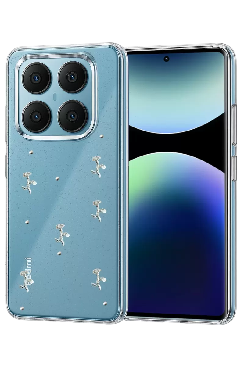 Newface Xiaomi Redmi Note 14 Pro 4G Fiyonk Desenli Kapak - Desen 4