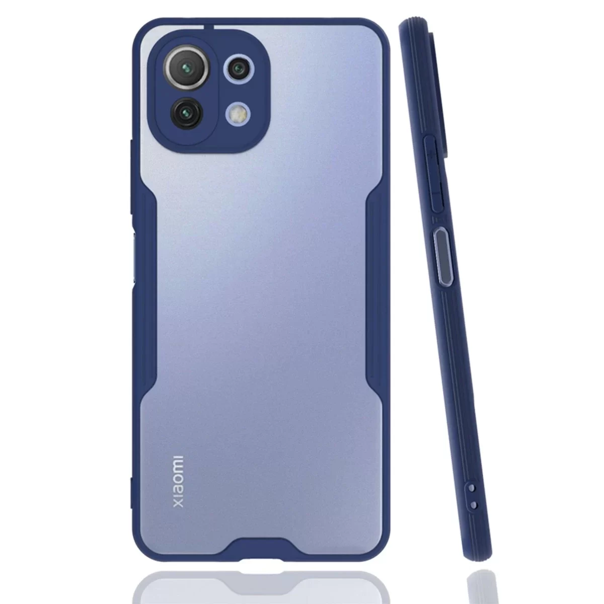 Newface Xiaomi Mİ 11 Lite Kılıf Platin Silikon - Lacivert