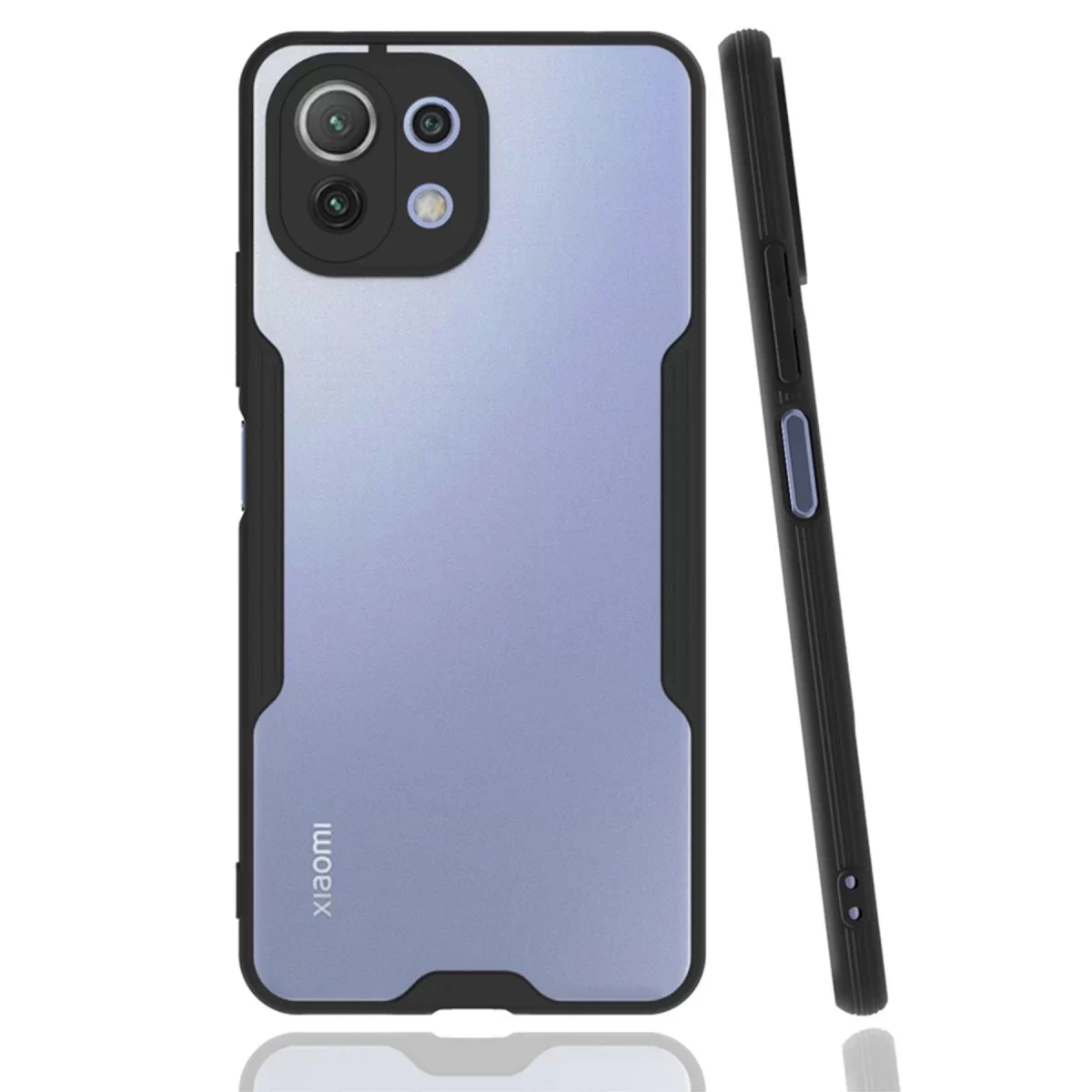 Newface Xiaomi Mİ 11 Lite Kılıf Platin Silikon - Siyah
