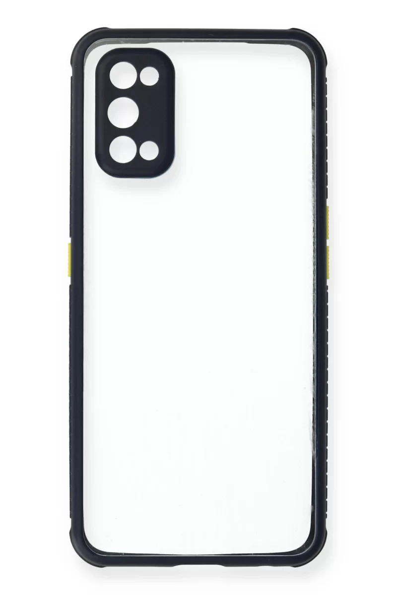 Newface Realme 7 Pro Kılıf Miami Şeffaf Silikon - Lacivert
