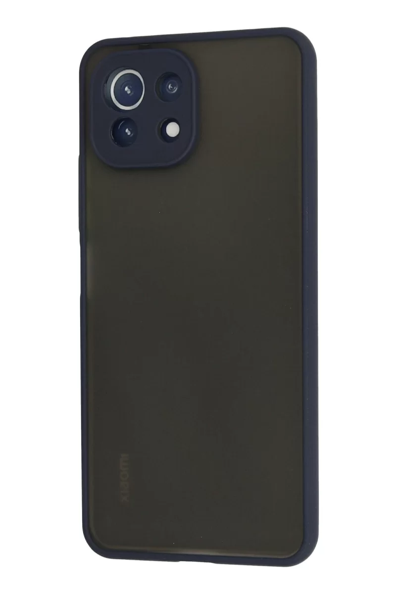Newface Xiaomi Mİ 11 Lite Kılıf Montreal Silikon Kapak - Lacivert