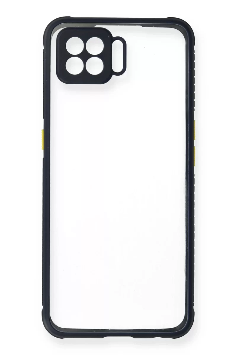 Newface Oppo A73 Kılıf Miami Şeffaf Silikon - Lacivert