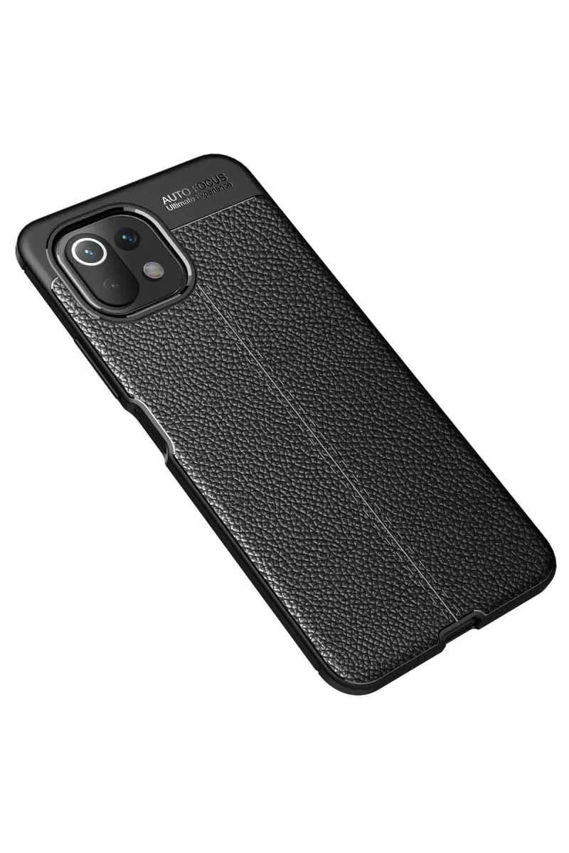 Newface Xiaomi Mİ 11 Lite Kılıf Auto Focus Kapak - Siyah