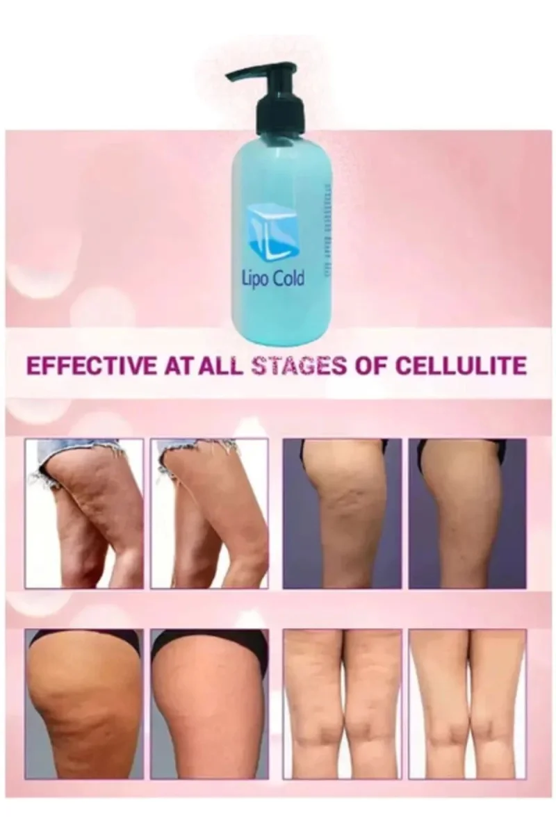 Lipo Cold Sıkılığa Inceliğe Hafifliğe Ve Selülilitlerinize Güçlü Etkide Krem 250 ml X 3 ADET