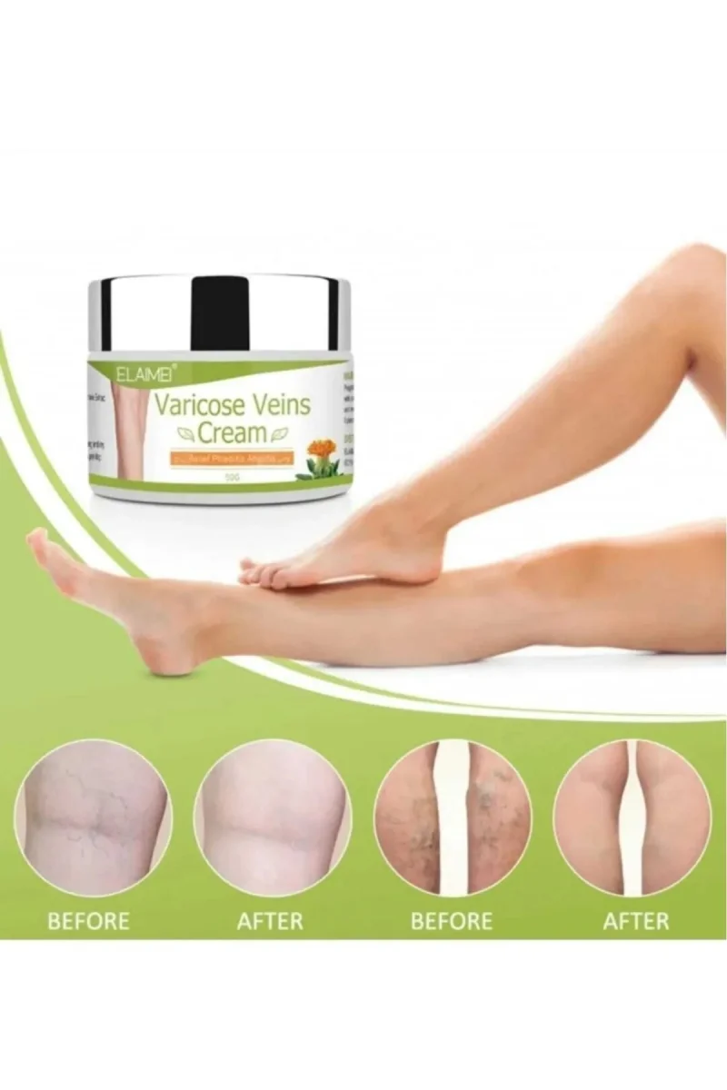 Varicose Veins Var.is Kremi 100 ML
