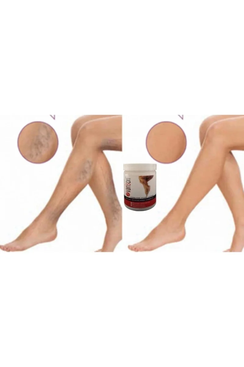 Varison Var.is Sellulit Bacak Bakım Kremi 200 ml