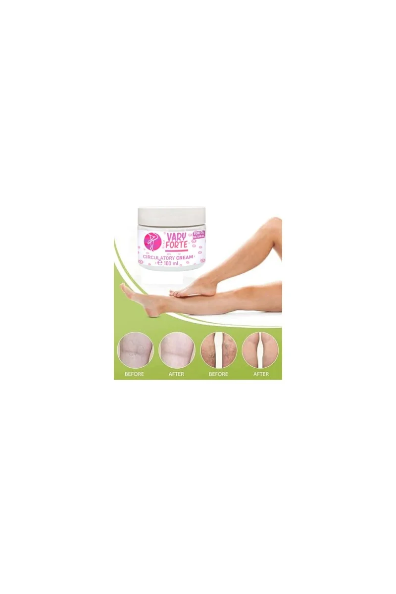 Vary Forte Kavanoz Yoğun Warislere Karşı Tesirli Krem 100 ml X 2 ADET