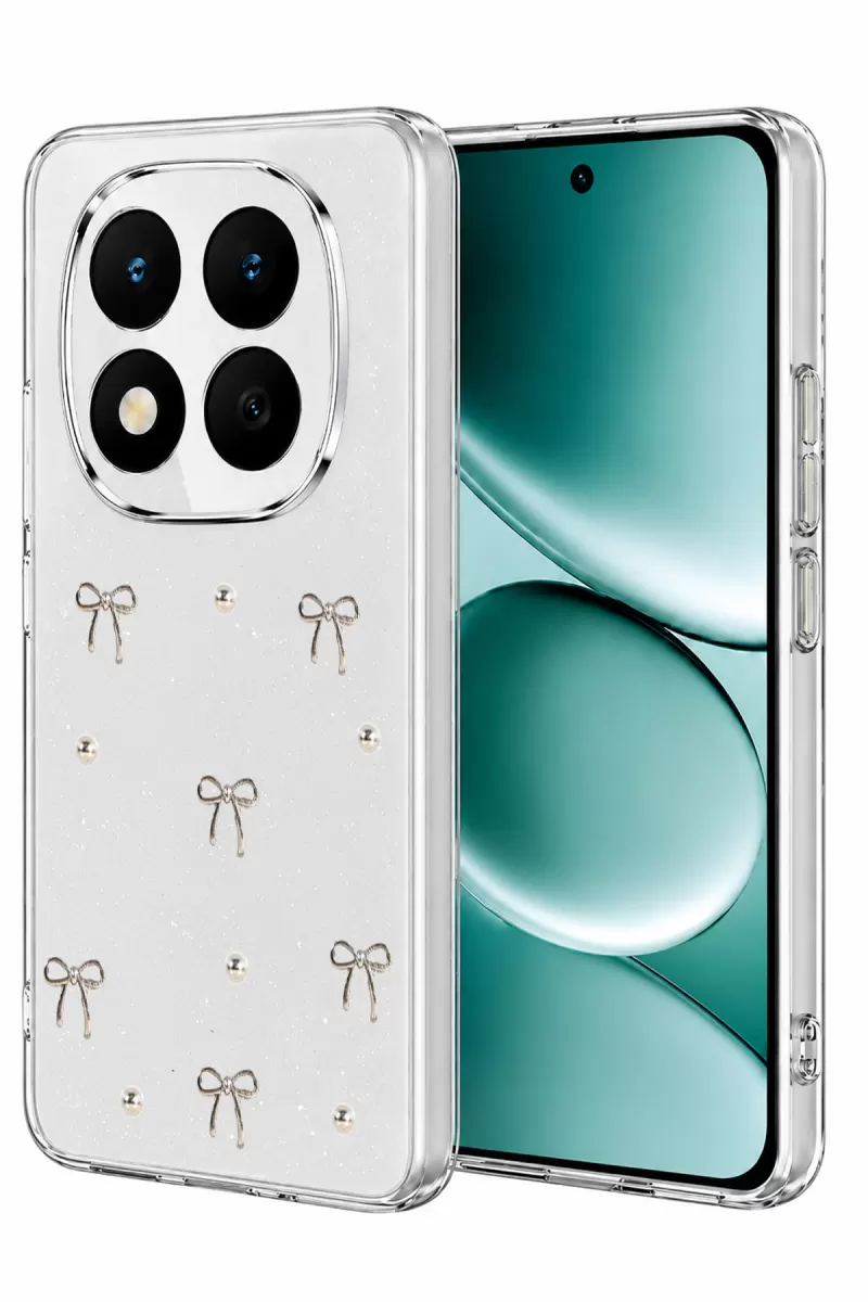 Newface Xiaomi Redmi Note 15 Pro Plus 5G Fiyonk Desenli Kapak - Desen 5