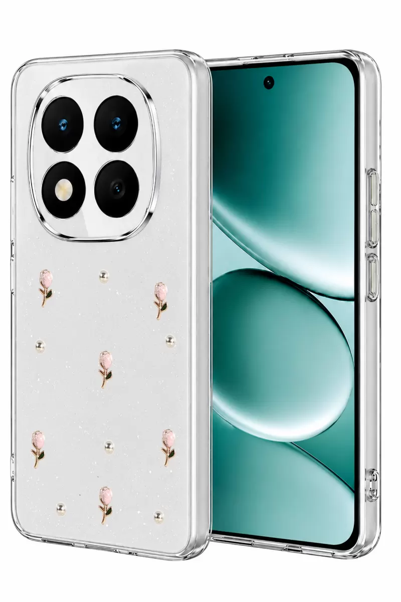 Newface Xiaomi Redmi Note 15 Pro Plus 5G Fiyonk Desenli Kapak - Desen 6