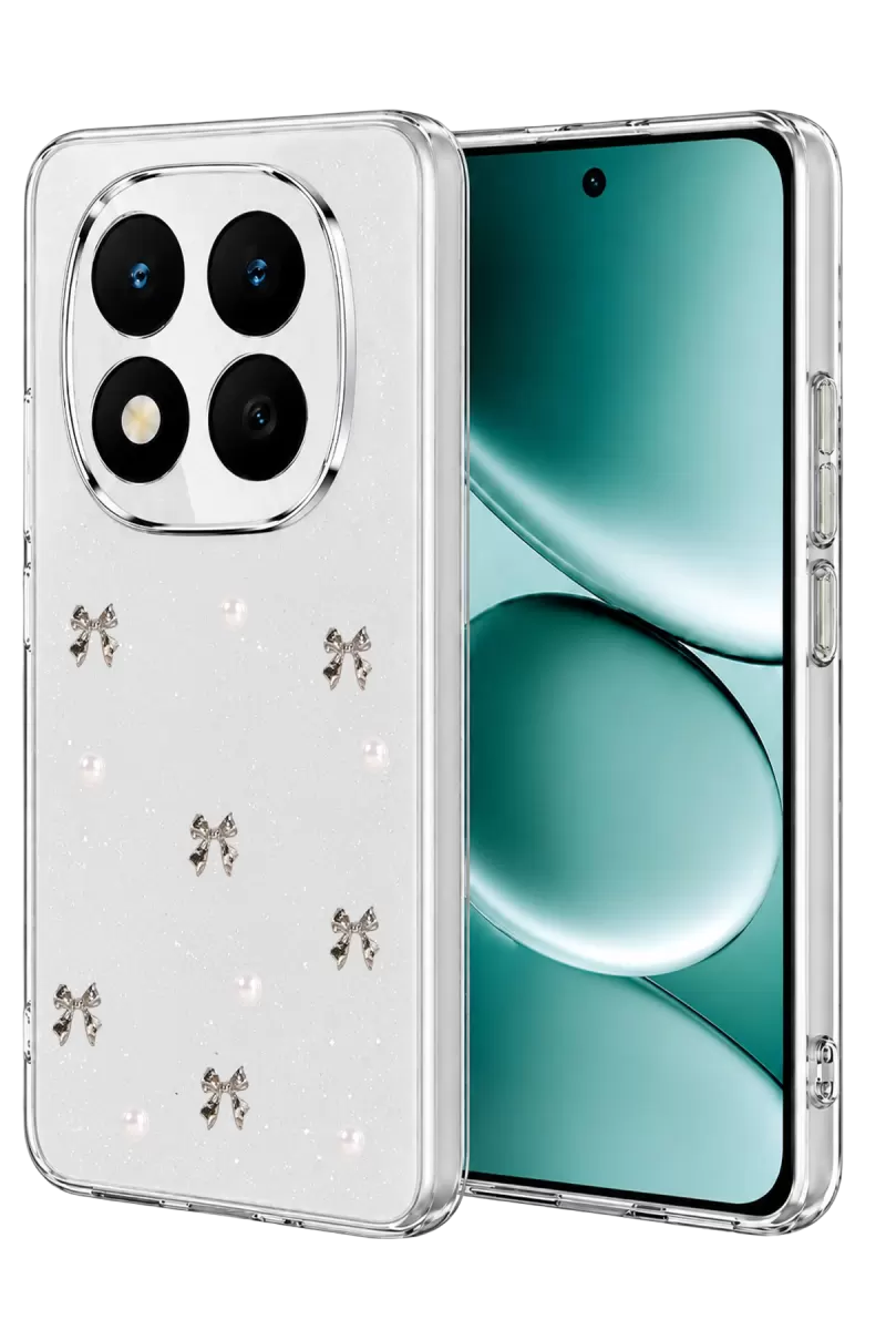 Newface Xiaomi Redmi Note 15 Pro Plus 5G Fiyonk Desenli Kapak - Desen 8